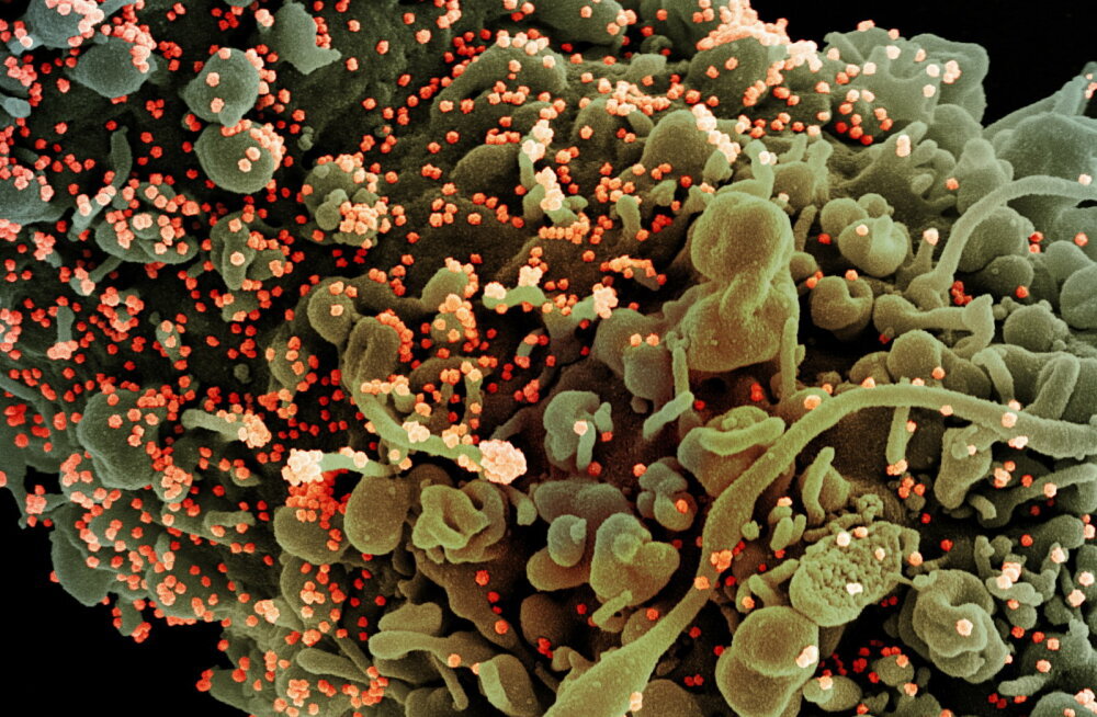 TEADLASTEL SELGUS MAJAS: SARS-CoV-2 siseneb meie organismi just nende ninas olevate rakkude kaudu